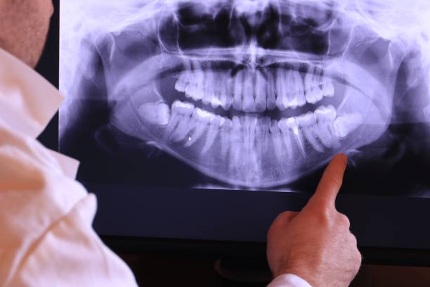Best Emergency Dental Extractions in Kermit, TX