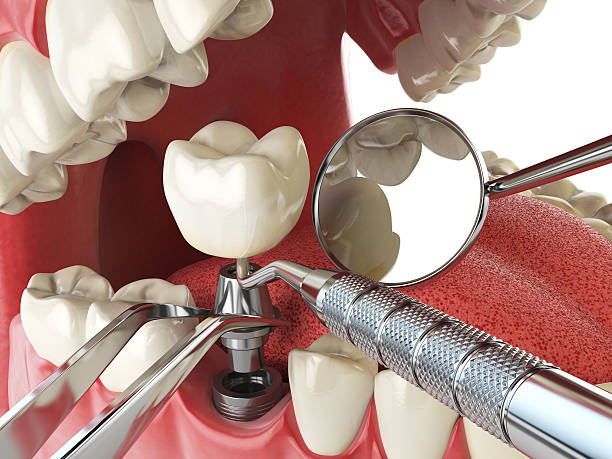 Best Holiday Emergency Dentist in Kermit, TX